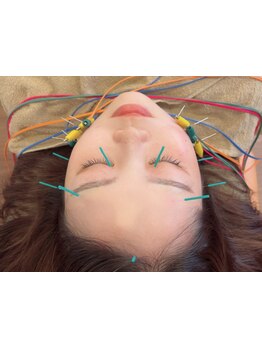 ホウレイ線・たるみ改善！予防ケア