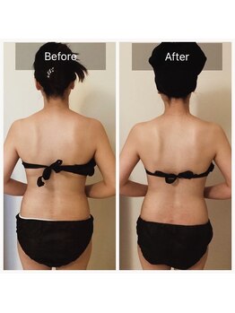 ソルーチェ(soluce)/ブライダルボディ3回目☆