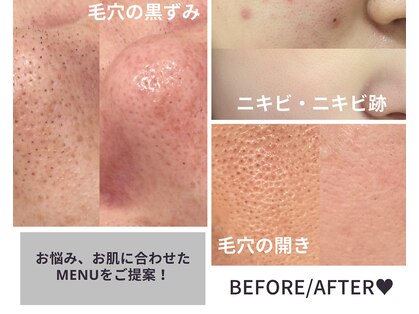 美肌ラボ クリア(clear)の写真