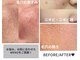 美肌ラボ クリア(clear)の写真