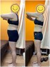 【人生で1番綺麗な姿に♪】前撮り・挙式に向けた本気のブライダル痩身コース
