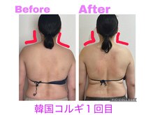 ルル(Ruru)の雰囲気（当店のコルギは、首肩の凝り・歪み、姿勢も改善していきます♪）