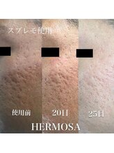 ベオ(Salon Beo)/ハーブのパワー