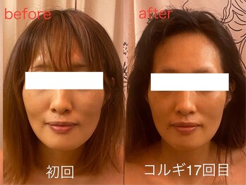 ビーキュート 神戸元町店(BE-CUTE)/コルギ17回目