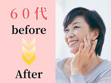 ココロ(COCORO)/60代ダイエットbefore→After