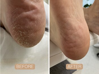 ペディラボ 荻窪店(Pedi Labo)