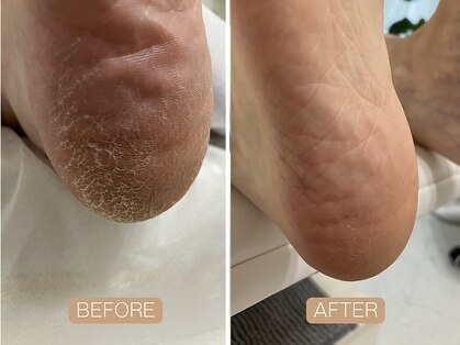 ペディラボ 荻窪店(Pedi Labo)の写真