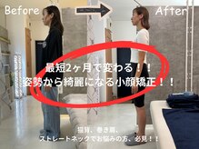 ファキエス(Facies)