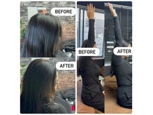 【40代 女性 デスクワーク】巻肩、肩こり、頭痛でご来店