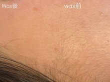 アイルーム 大宮店(eyeroom)/パーツ脱毛