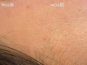 アイルーム 大宮店(eyeroom)/パーツ脱毛