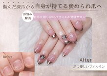 ティアラネイル 宇都宮