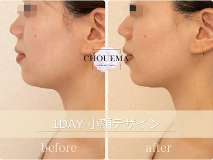シュエマ(CHOUEMA)の写真