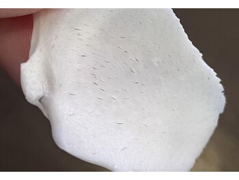 エステサロン桜/毛と一緒に、鼻の角栓撃退！！