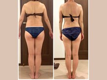 リライブ 亀有店(Re:Lives)/全身ビフォーアフター【痩身】