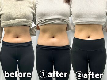 モア 札幌大通店(MORE)/くびれの質にもこだわるのがMORE