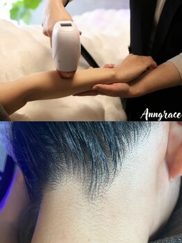 アングレイス(Anngrace)の写真/【最先端脱毛機でワンランク上の脱毛デビューを♪】初めての脱毛だからこそ、熟練のプロにお任せください＊