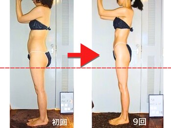 痩身 セル脂肪専門 スタイルデザイン