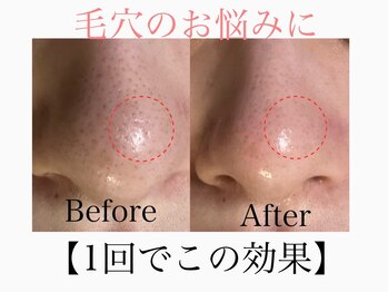 アンドエス 六本木(and S.)