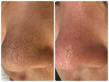 サイセイ(SAISEI)/