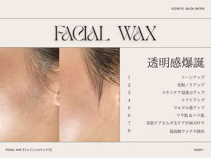 アンティエの写真