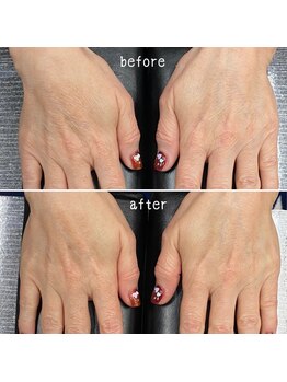 ハンドエステ付ジェルネイル