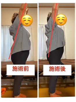 にこ。/整体による姿勢の変化