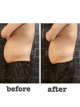 ルブレ 山形店(RUBURE)/30分横になってるだけ！