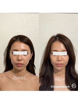 エクボ 立川店(EKUBO)/