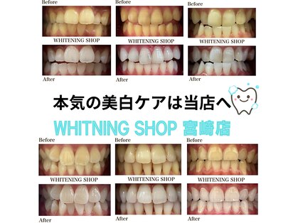 ホワイトニングショップ 宮崎店の写真