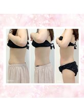 リアム(LiAm)/痩身エステ ダイエット