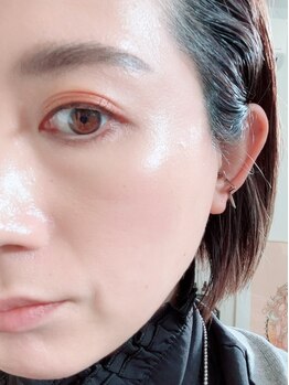 アート 熊本並木坂店(ART)の写真/2月から全国一斉スタート☆圧倒的な美白を叶える♪美白ワックス！うぶ毛＆角質ケア/プラズマフォト