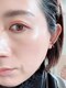 アート 熊本並木坂店(ART)の写真/2月から全国一斉スタート☆圧倒的な美白を叶える♪美白ワックス！うぶ毛＆角質ケア/プラズマフォト