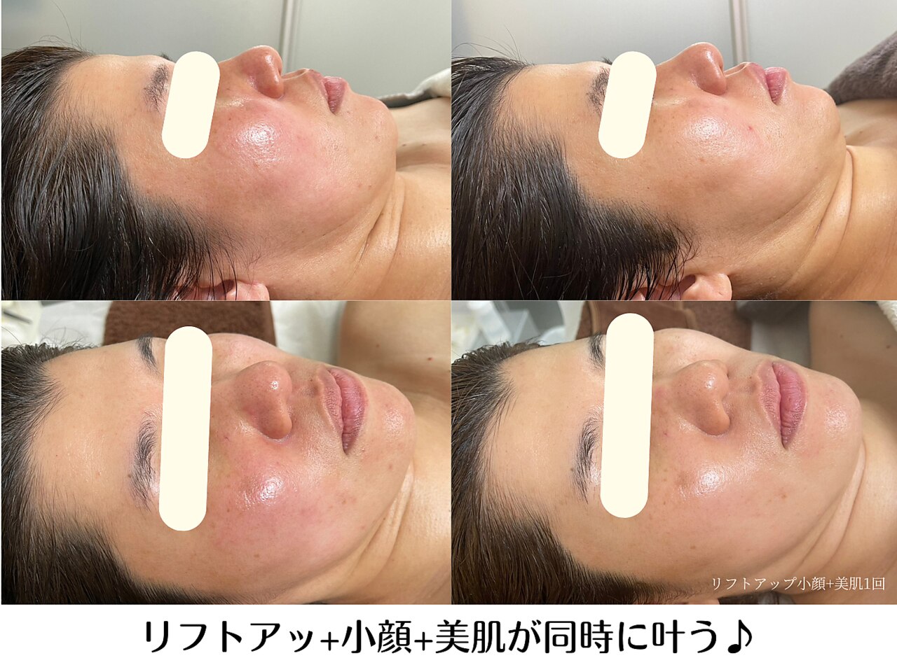 リクラ(Reclat)｜ホットペッパービューティー