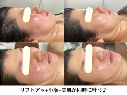 リクラ(Reclat)の写真