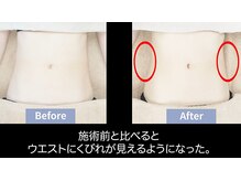 ローブメール(Robemail)/ウエストスッキリ!!