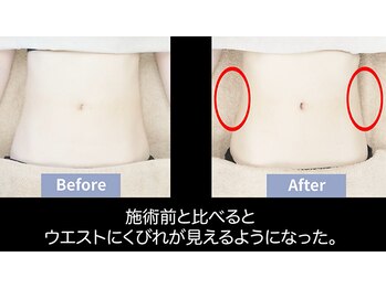 ローブメール(Robemail)/ウエストスッキリ!!