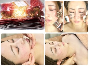 ベルラ(BELLRA)の写真/速攻小顔になりたい方へ【強力★サーマルFリフト(全顔打ち放題)&小顔3層表情筋EMS+本格リンパ】¥11900/新規