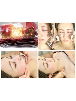 小顔になりたい