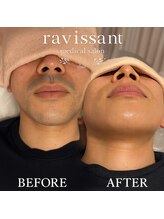 ラヴィソン(ravissant)/夕方も気にならない！