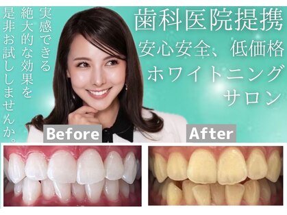 ホワイトニングショップ 湘 南辻堂店の写真
