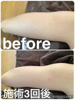 ギンザアール(GINZA R.)/