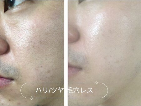 モアスキン 南青山店(MORE SKIN)｜ホットペッパービューティー