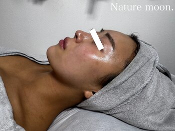ナチュールムーン(Nature moon.)/ハーブピーリング after
