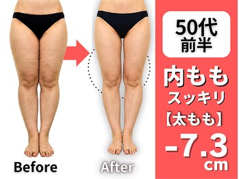 マルデビジュ 西宮(Mar de Bijou)の写真/実績と経験を積んだオーナーによる独自ダイエット法が人気の秘訣◎納得の施術！全身のシルエットが大変身♪
