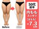 マルデビジュ 西宮(Mar de Bijou)の写真/実績と経験を積んだオーナーによる独自ダイエット法が人気の秘訣◎納得の施術！全身のシルエットが大変身♪