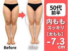 マルデビジュ 西宮(Mar de Bijou)