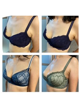 ハイファイブ(Hi-Five)/バストアップ/（施術10回）