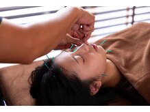 ココロ(CoCoLo)/美容鍼灸