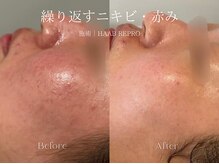 エメ(Aimee)/HAAB REPRO